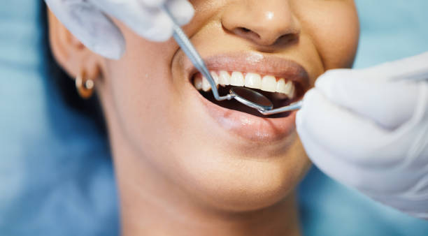 Best Emergency Root Canal Treatment in Fiskdale, MA